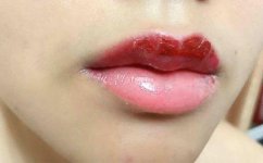 Tại sao môi trên bong ra thường đậm hơn môi dưới?.1_Xambiz by mailyngo