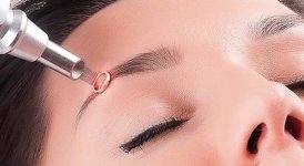 Sau khi xóa lông mày, bao lâu sau có thể làm lại được?.1_Xambiz by minhnguyet