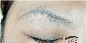 Nguyên nhân lông mày bị trổ xanh và cách phòng tránh.1_Xambiz by bichngoc