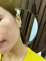 Cách Chăm Sóc Da Với Bộ 3:  AHA - HA - Retinol.1_Xambiz by datcoca