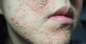 Hậu quả khôn lường khi dùng mỹ phẩm giá rẻ không rõ nguồn gốc.1_Xambiz by ngocha