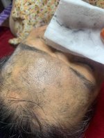 Khi nào thì cần phải thải độc chì? Dấu hiệu bị nhiễm chì.1_Xambiz by uyenhoang