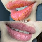 Mọi người đã biết xử lý môi xỉn tím chưa ???.1_Xambiz by jaytee