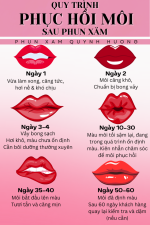 QUY TRÌNH PHỤC HỒI MÔI SAU PHUN XĂM.1_Xambiz by Quynh Huong PMU