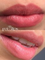 DÙNG MỰC BÓC TÁCH MỰC.1_Xambiz by MyVienNgo