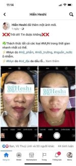 Lý do các chủ Spa, bác sĩ, dược sĩ lựa chọn sản các phương pháp chuẩn y khoa.1_Xambiz by GiangSpa