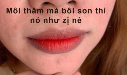 Môi thâm thì có đánh son cũng không thể đẹp như phun môi được.1_Xambiz by vunhung