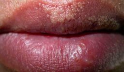 Khách phun môi xong bị như này là sao vậy ạ?.1_Xambiz by letuyetnhi