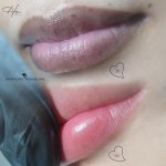 Phun xăm có thể xoá được các chấm đồi mồi, tàn nhang hoặc nốt ruồi trên môi không?.1_Xambiz by thammynhuy