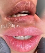 TRIỆT SỪNG TRIỆT THÂM.1_Xambiz by MyVienNgo