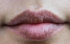 Cách phun môi cho khách thường xuyên bị khô môi?.1_Xambiz by tuuyen