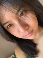 PEEL DA KHÁC LỘT DA - Chị em chú ý nhé!.1_Xambiz by thaithuyspa