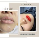 [Có video] 5 lưu ý trước và sau khi phun môi.1_Xambiz by vantang