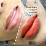 Những cách trị thâm môi phổ biến.1_Xambiz by hoangchinh