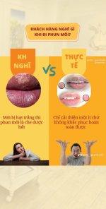 Những lầm tưởng của khách hàng khi đi phun môi - Phần 1.1_Xambiz by nhuhuynh