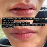 Nguyên nhân và cách xử lý môi bị hỏng.1_Xambiz by hahin